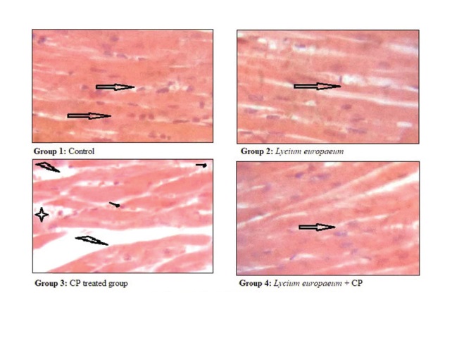 In vivo cardioprotective effect of a polysaccharide from Lycium europaeum on cisplatin-induced heart injury in mice