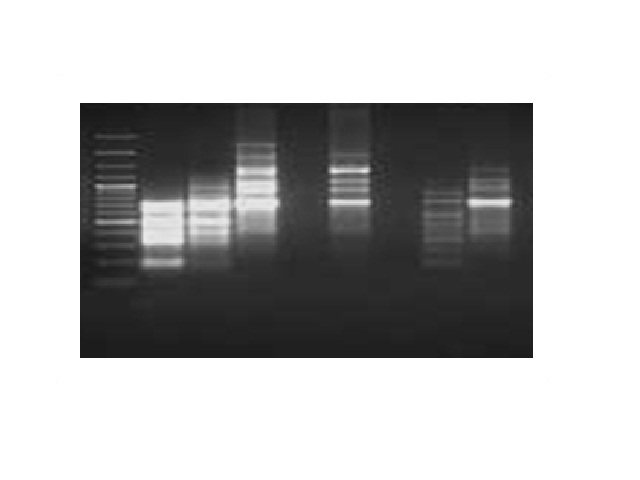 Study of the Genetic Variations in Different Variants of Tribulus terrestris L. in Rayalaseema Region in Andhra Pradesh