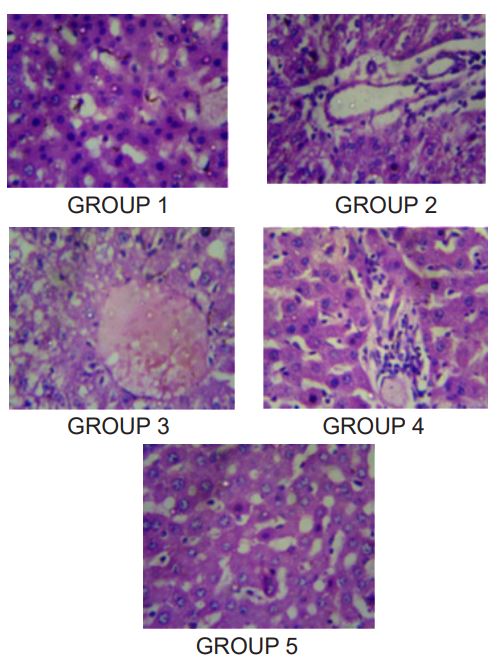 Histopathological changes showing the effect of EEBG on the rats with paracetamol-induced hepatotoxicity.