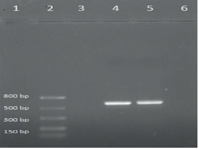 rbcL region amplifi cation of Piper longum; Lane 2 is the DNA ladder, Lane 4 is the male plant, and Lane 5 is the female plant.
