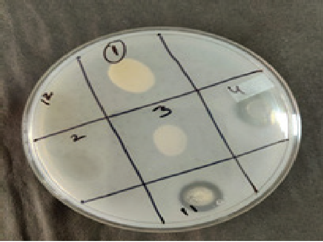 Screening of Phytate hydrolyzing bacteria