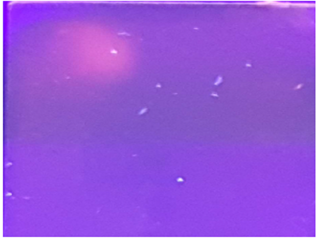 Comet image of blood sample of agricultural workers after exposure to pesticides visualized under UV transilluminator