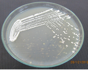 Isolation of S. terrae on starch casein nitrate (SCN) agar plate