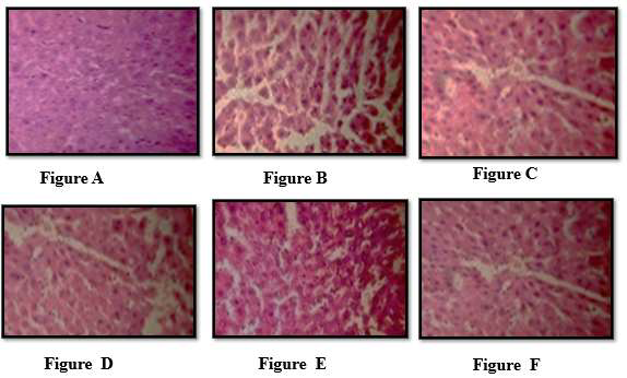 A, B, C, D, E, F: Effects of HABD, HAAR and Glibenclamide on histopathological changes induced by Dexamethasone induced diabetes in Wistar rats. Figure A: Normal (CMC treated), Figure: B NC (Dexamethasone), Figure: C Dexamethasone + Glibenclamide, Figure D: Dexa + HABD, Figure E: Dexa + HAAR, Figure F: Dexa + HABD+ HAAR