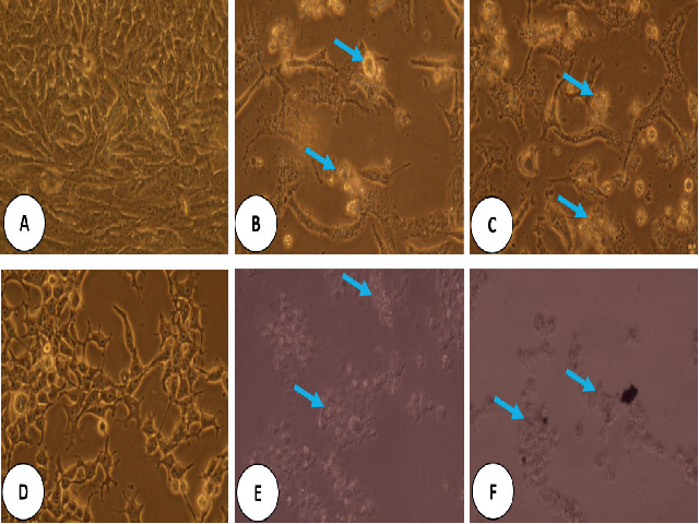 Micro-morphology of cancer (A549) and normal (HEK-293) cells treated with IC50 value of VCFE and cisplatin.