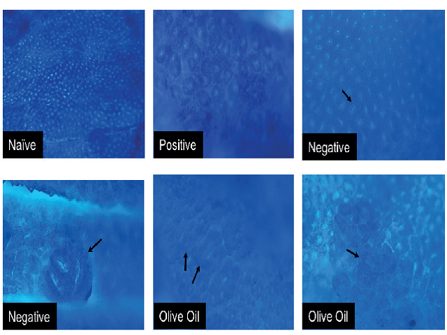 A microscopic view of the whole mounts of methylene blue stained colonic showing